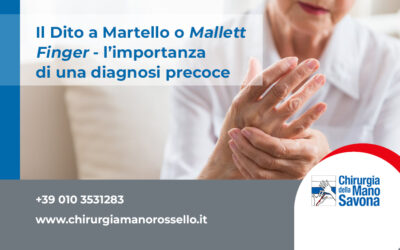 Il Dito a Martello o Mallett Finger: l’importanza di una diagnosi precoce!