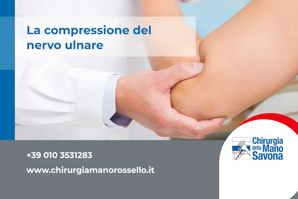 La compressione del nervo ulnare